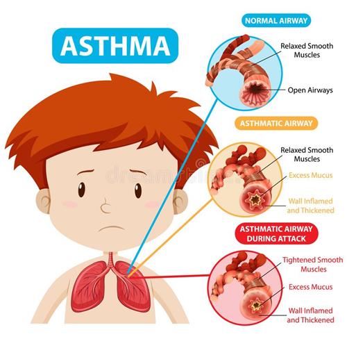 Nurse's Nook / Asthma Management